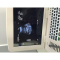 ultrasound machine price and ultrasound machine for pregnancy